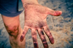生理中のオイリー肌に効果的な対策は？